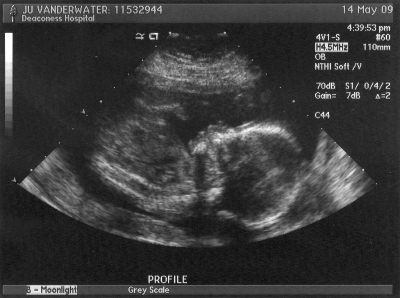 May 09 Ultrasound Blue