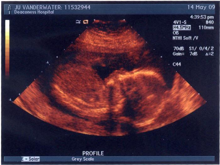 May 09 Ultrasound Red